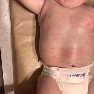 Submitted by Mattison M