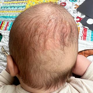 Submitted by Rebecca A