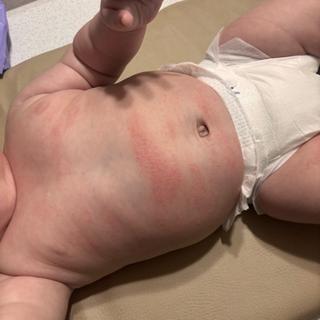 Submitted by Mattison M