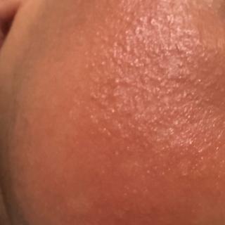 Submitted by Eliset G