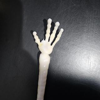 Lost his finger