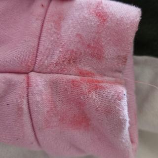 Multiple washes with stain remover